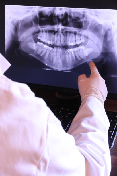 Best Emergency Dental Care for Broken or Chipped Teeth in Geneva, WA