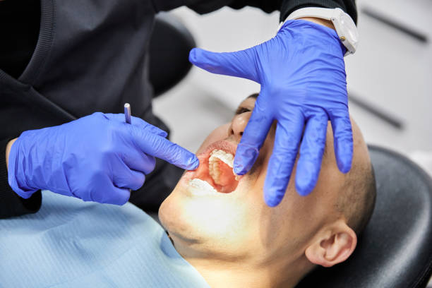 Best Emergency Treatment for Dental Infections or Abscesses in Geneva, WA